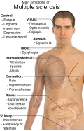 Thumbnail for version as of 18:47, 3 February 2009