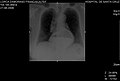 Thumbnail for version as of 17:36, 11 May 2010