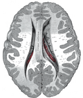 Thumbnail for version as of 05:16, 29 January 2006