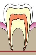 Thumbnail for version as of 00:00, 16 February 2007