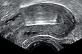 Thumbnail for version as of 18:37, 23 June 2014