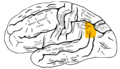 Lateral surface of left cerebral hemisphere, viewed from the side. Angular gyrus is shown in orange.