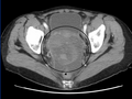 Thumbnail for version as of 18:57, 4 August 2011
