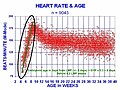 M-mode sonography measuring embryonic heart rate.