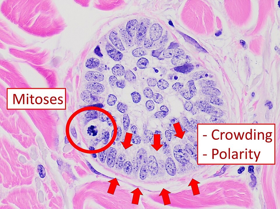 File:Systematic microscopy 4 - Cellular arrangement.jpg