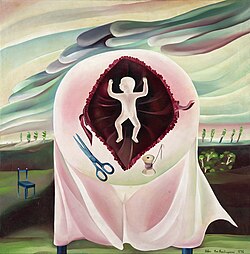 Section (Caesarean), 1976, oil, 100x100cm