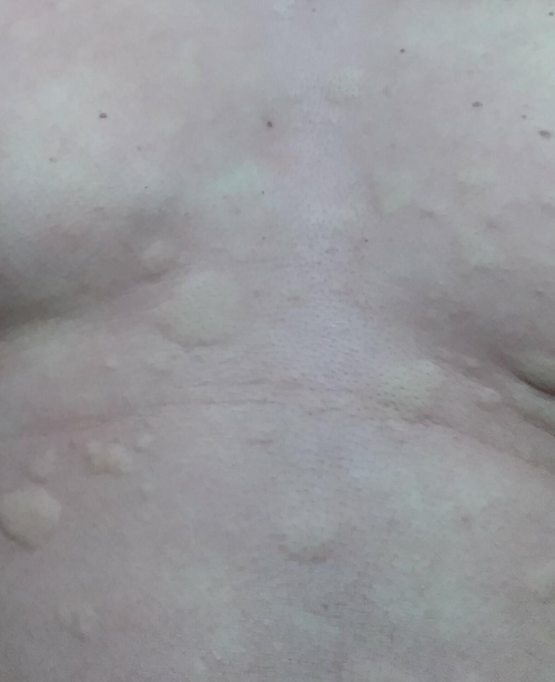File:Hives2018.png