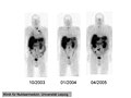 Thumbnail for version as of 09:44, 21 August 2007