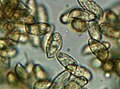 Gomphus floccosus spores