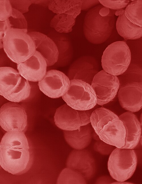 File:Lactococcus lactis, scanning electron micrograph.jpg