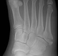 Thumbnail for version as of 13:06, 17 August 2014