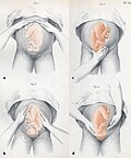 Thumbnail for version as of 13:35, 15 March 2009