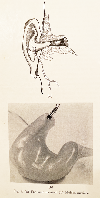 File:Ovulation Detection.png