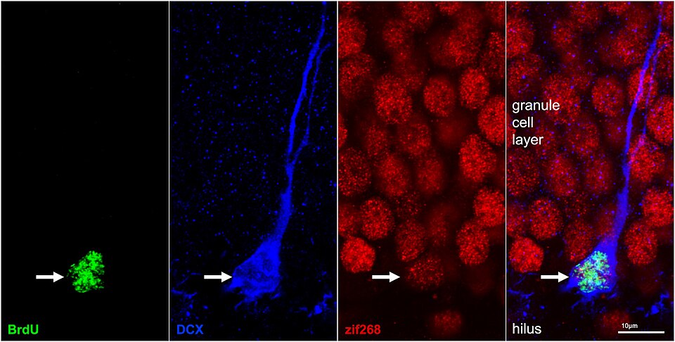 File:BrdU staining (green) of radial glia.jpg
