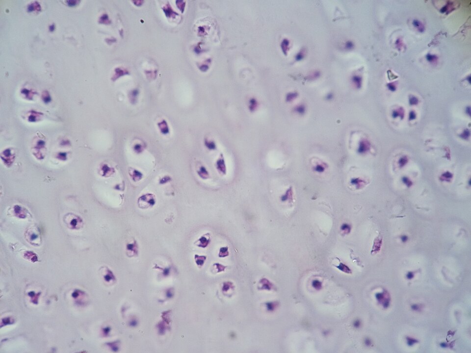 File:Cartilage01.JPG