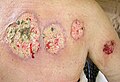 Thumbnail for version as of 23:18, 24 June 2007