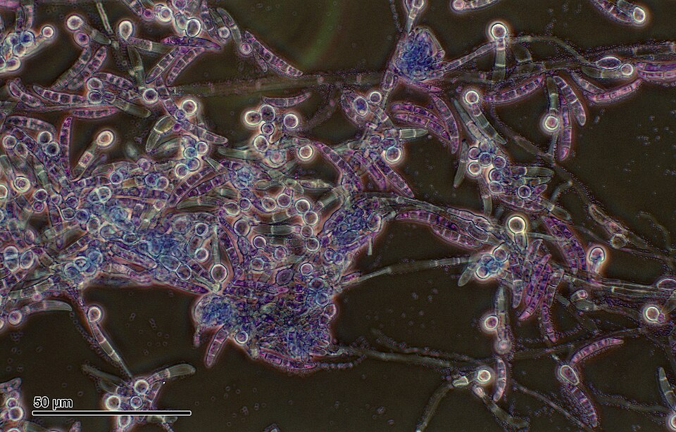 File:Pythium (257 23).jpg