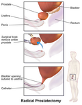 Thumbnail for version as of 21:44, 5 November 2015