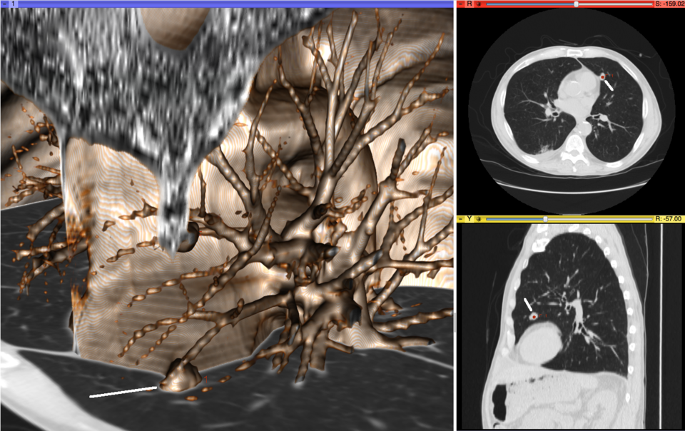 File:Visualization of Medical Imaging.png
